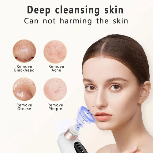 Blackhead Remover Pore Vacuum Face Nose Deep Cleaning Electric Pimple