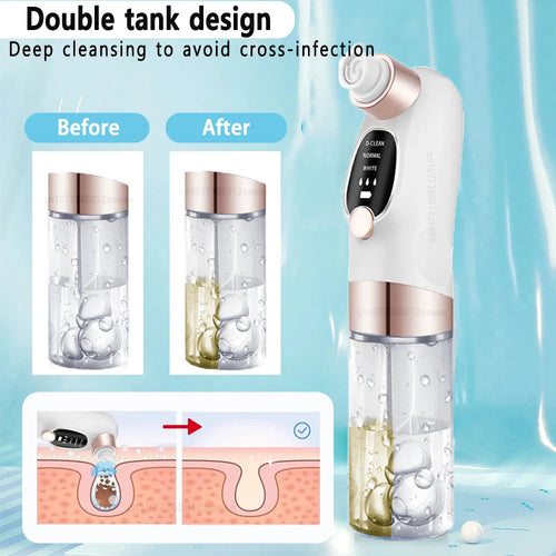 Blackhead Remover Pore Vacuum Face Nose Deep Cleaning Electric Pimple