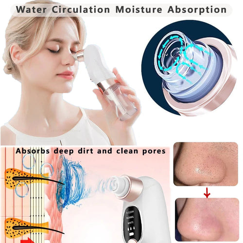 Blackhead Remover Pore Vacuum Face Nose Deep Cleaning Electric Pimple